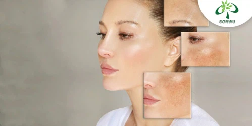 Gallic acid Skin Health