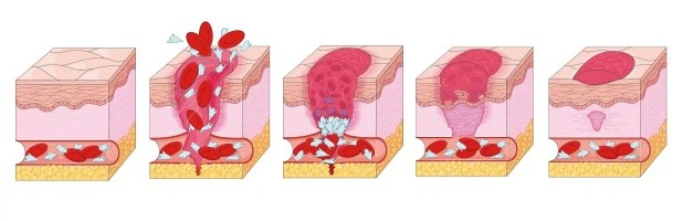 slow blood clotting