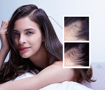 Gubitak kose u proljeće? Još nije kasno da to učinite sada!